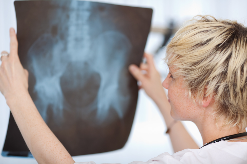 Doctor holding x-ray of pelvis